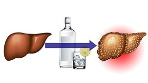 efectele alcoolului asupra ficatului