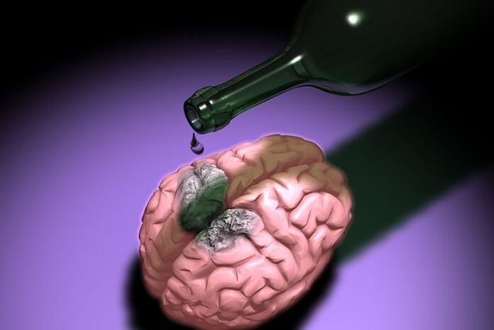 cum afectează alcoolul creierul